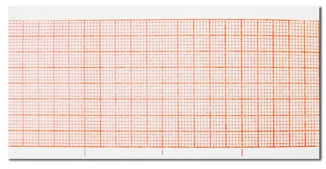 [2905005] Hojas de papel grado médico de 50x100mm (para desfibrilador Nihoon Kohden TEC5521 y TEC5531) C/200